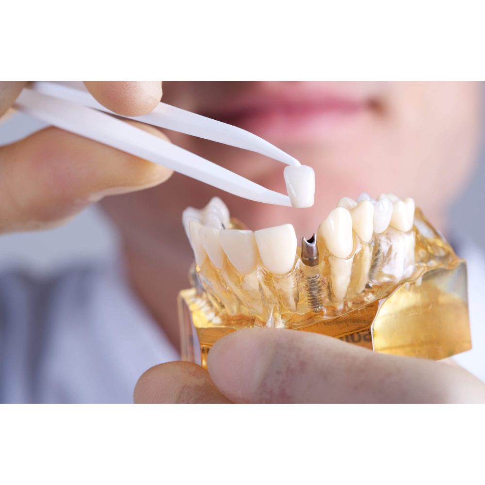 Reabilitação Oral – Prótese